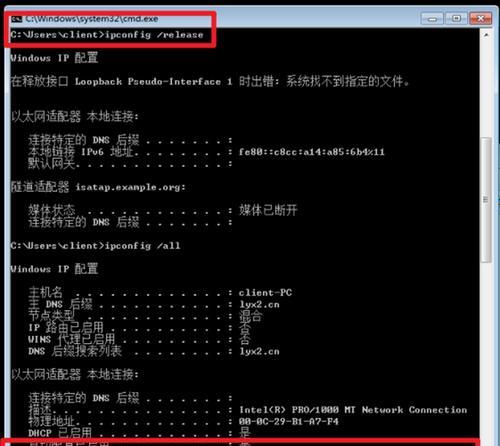 CentOS网卡配置管理步骤是什么？